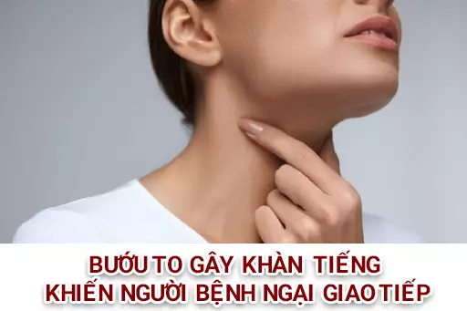 Buou-co-to-co-the-gay-chen-ep-len-thanh-quan-gay-khan-tieng.webp